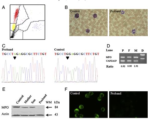 A nonsense mutation in the myeloperoxidase gene is responsible .